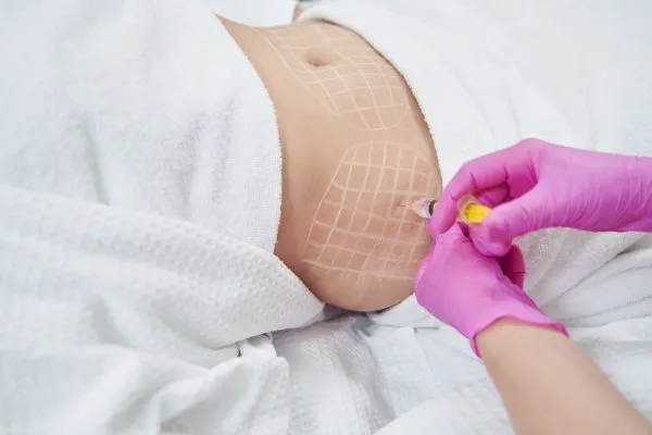 image of fat dissolving injections on love handles to help combat weight gain Garston